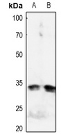 Anti-IGFBP3 (Phospho-S183) Antibody