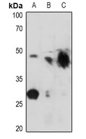 KCNJ11 (phospho-T224) antibody