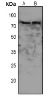 Anti-WEE1 (Phospho-S642) Antibody