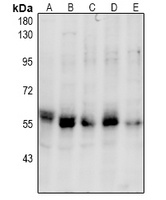 Anti-PINK1 (Phospho-S228) Antibody