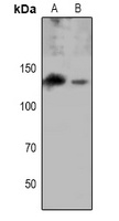 EPHA8 (phospho-Y615) antibody