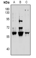 Anti-Vimentin (Phospho-S39) Antibody