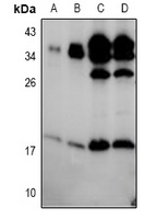 Anti-BIK (Phospho-S35) Antibody