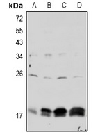 Anti-Claudin 4 (Phospho-Y208) Antibody