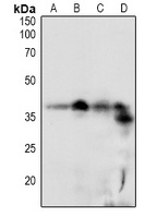 RCAN1 (phospho-S108) antibody