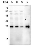 RGS19 (phospho-S151) antibody