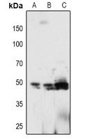 Anti-PTP1B (Phospho-Y66) Antibody