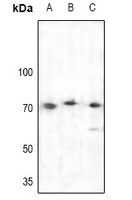 Anti-BTK Antibody
