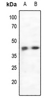 CCR5 antibody