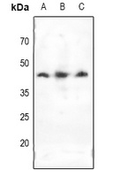 Anti-Doublecortin Antibody