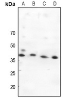 Anti-MKK4 Antibody