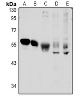 Anti-TSG101 Antibody