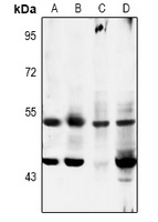 Anti-MKK5 (Phospho-S311) Antibody