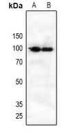 IL21R antibody