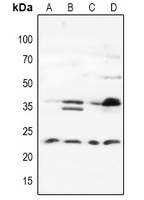 MAD2L1BP antibody