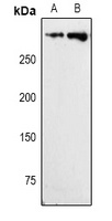 Anti-Ki67 Antibody