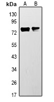 Anti-ACSL3 Antibody