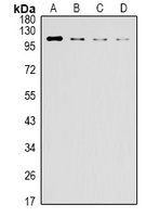 Anti-IRE1 Antibody