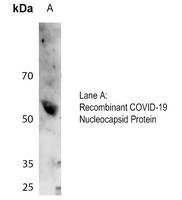 Anti-COVID-19 Nucleocapsid Protein Antibody