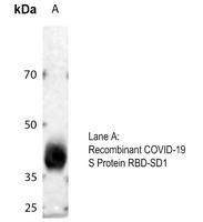 COVID-19 Spike glycoprotein antibody