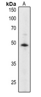 Anti-ABI2 Antibody