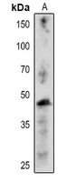 CFBP1 antibody