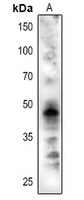 Anti-CRD1 Antibody
