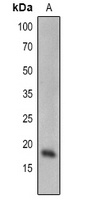 Anti-SCE1 Antibody