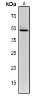 TIC40 antibody