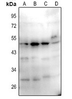 Anti-CD1a/b Antibody