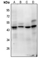 Histone H1oo (AcK163) antibody