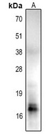 Histone H2B (AcK85) antibody