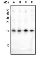 HMGN2 (AcK31) antibody