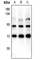 Anti-FOXO1/3 (Phospho-S322+S325/pS318+S321) Antibody