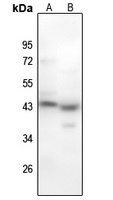 MYOD1 (pS200) antibody