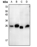 Anti-Thymidine Kinase 1 (Phospho-S13) Antibody