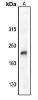 Anti-VEGFR2 (Phospho-Y1059) Antibody