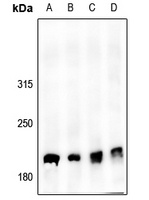 Anti-53BP1 (Phospho-S6) Antibody