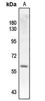 Anti-SMAD2 (Phospho-T220) Antibody