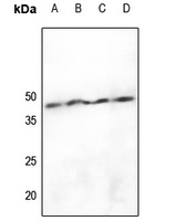 hnRNP D0 (pS83) antibody