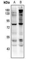 Anti-CD127 (Phospho-Y449) Antibody
