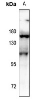 Anti-Aconitase 1 (Phospho-S138) Antibody