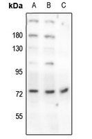 Anti-Beta-NaCH (Phospho-T615) Antibody