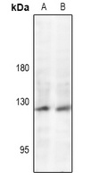 Anti-JAK2 (Phospho-Y221) Antibody