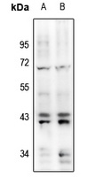 ERK1/2 (pY204) antibody