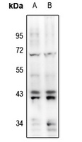 Anti-ERK1/2 (Phospho-Y204) Antibody
