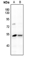 Anti-JNK1/2/3 (Phospho-Y185) Antibody