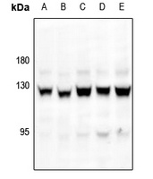 Focal Adhesion Kinase (pS843) antibody