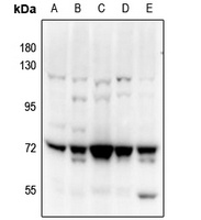 PAK4/5 antibody