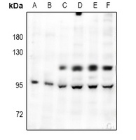 Anti-c-FER Antibody
